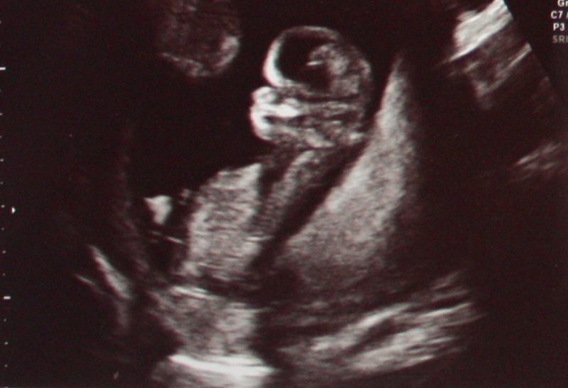 Mum Moments - Baby Scan Photos